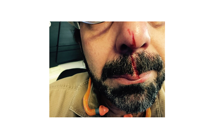 Proper use of PPE in our Industry - Incident Recreation